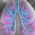 Kann Asthma Sie später im Leben betreffen?